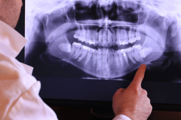 Best Emergency Root Canal Treatment in Tyndall, SD